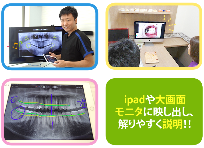 画像（レントゲンや口腔内写真など）をipadに取り込み解りやすく説明!