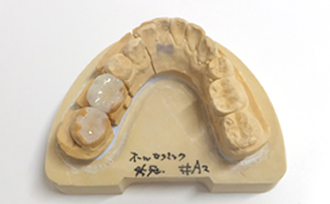 左下模型上セラミック