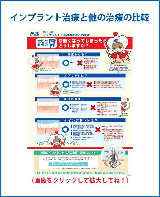 インプラント治療と他の治療の比較